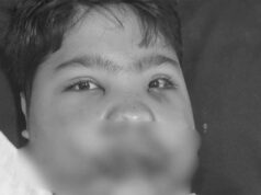 MP में फ्रिज फटा: मासूम की 108 हड्डियां टूटी, डॉक्टरों ने 5 घंटे में लौटाई जिंदगी